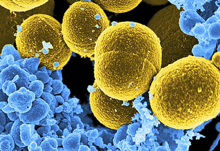 Staphylococcus-aureus